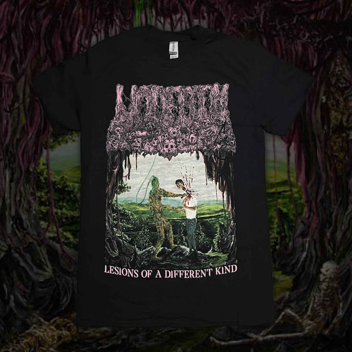 ‘Undeath’ - Lesions Of A Different Kind T-Shirt